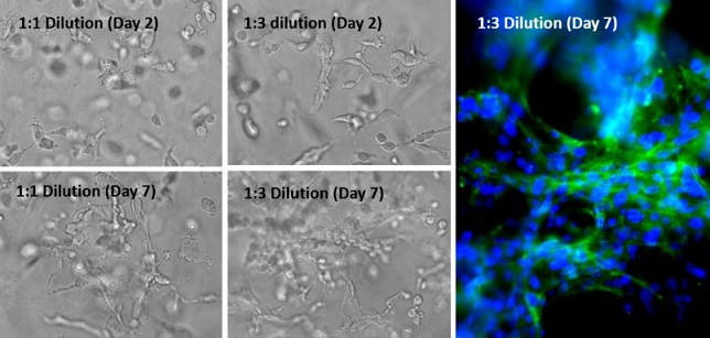 U-87 MG cells growth in VitroGel 3D-RGD